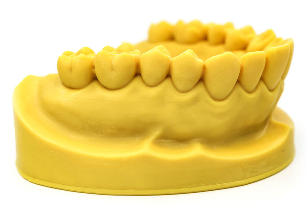 Explorer Max Dental Model Sample 3D Print
