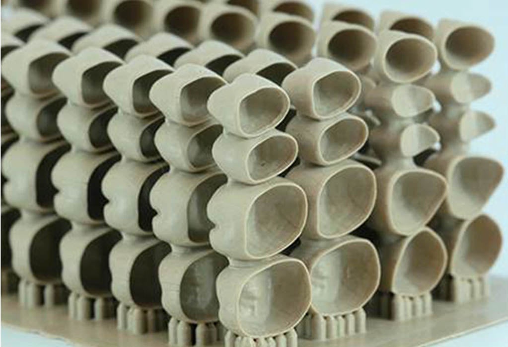 3D Printed Denatl Crowns